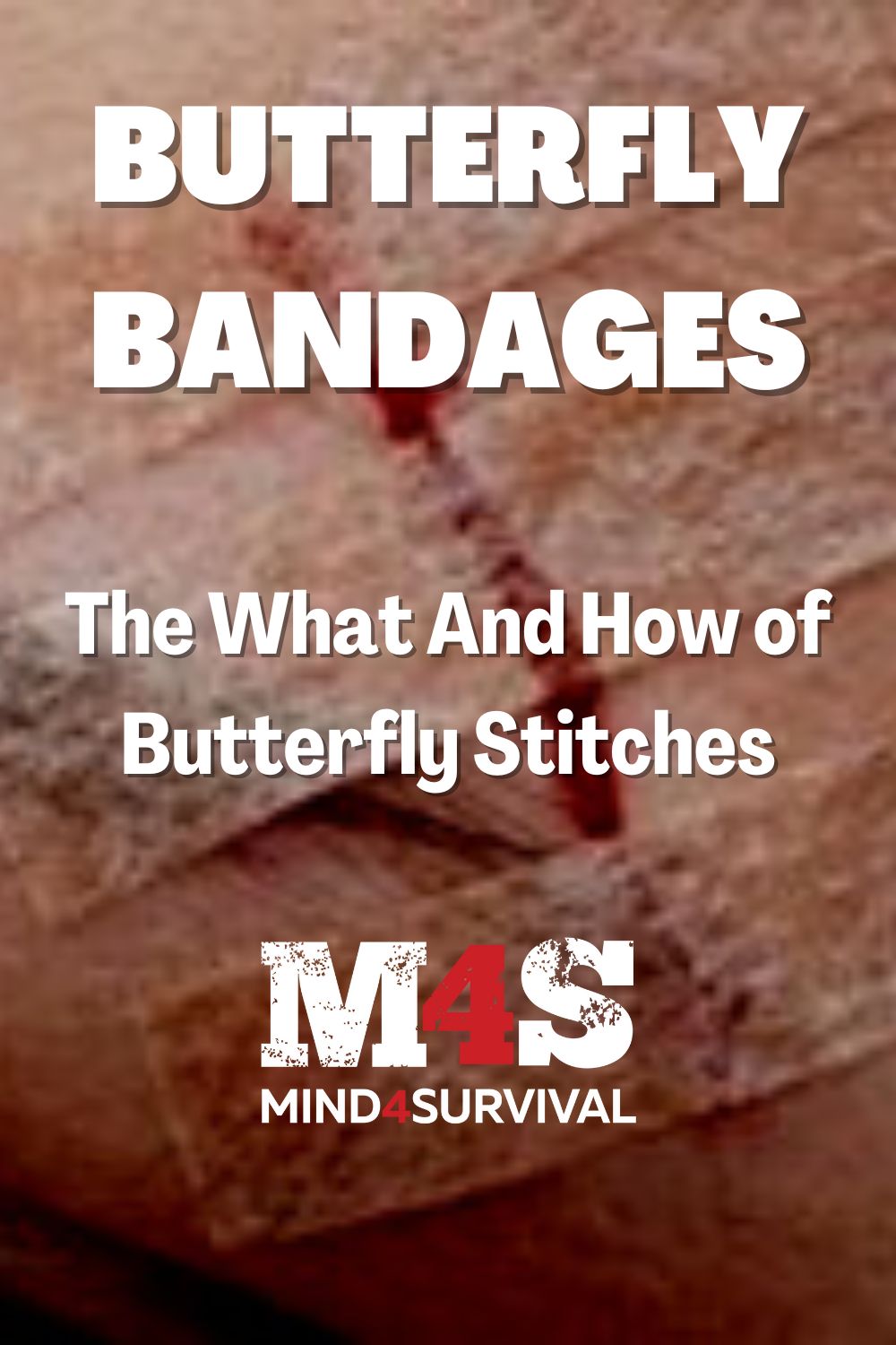 Butterfly Bandage or Stitches - Ansel's wound , cut, scrap…