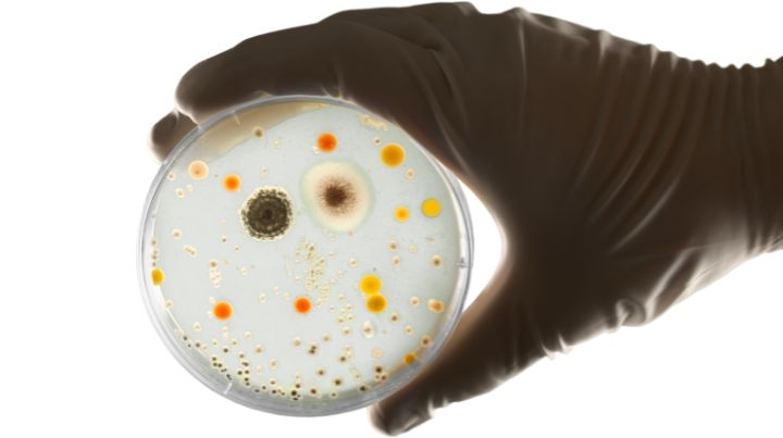 Bacteria in petri dish.