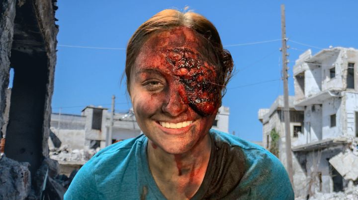 Personal with wounded face in front of destroyed building