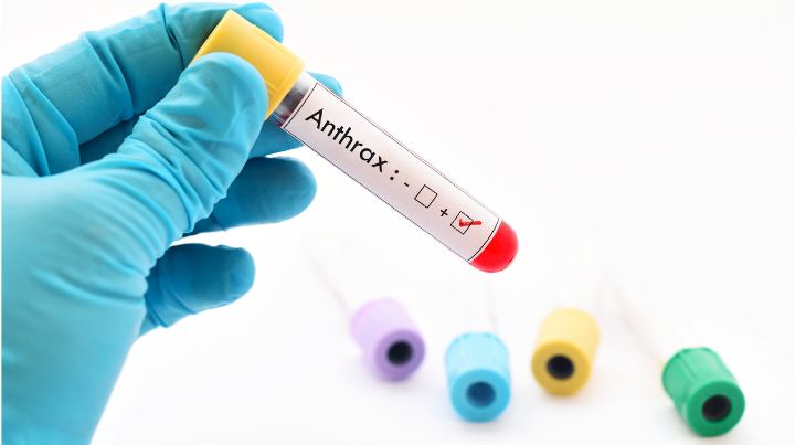 A vial of anthrax